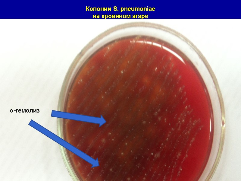 Колонии S. pneumoniae на кровяном агаре  α-гемолиз